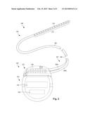 LEAD ANCHORS AND SYSTEMS AND METHODS EMPLOYING THE LEAD ANCHORS diagram and image