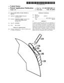 MALLEABLE IMPLANTABLE MEDICAL DEVICE diagram and image