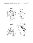 MALLEABLE IMPLANTABLE MEDICAL DEVICE diagram and image