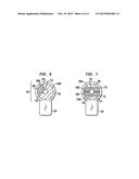 MALLEABLE IMPLANTABLE MEDICAL DEVICE diagram and image