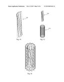 IMPLANTABLE FLOW ADJUSTER diagram and image