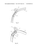 IMPLANTABLE FLOW ADJUSTER diagram and image