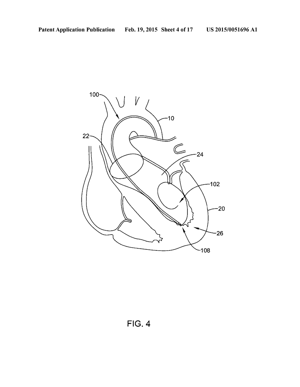 MEDICAL GUIDEWIRE - diagram, schematic, and image 05