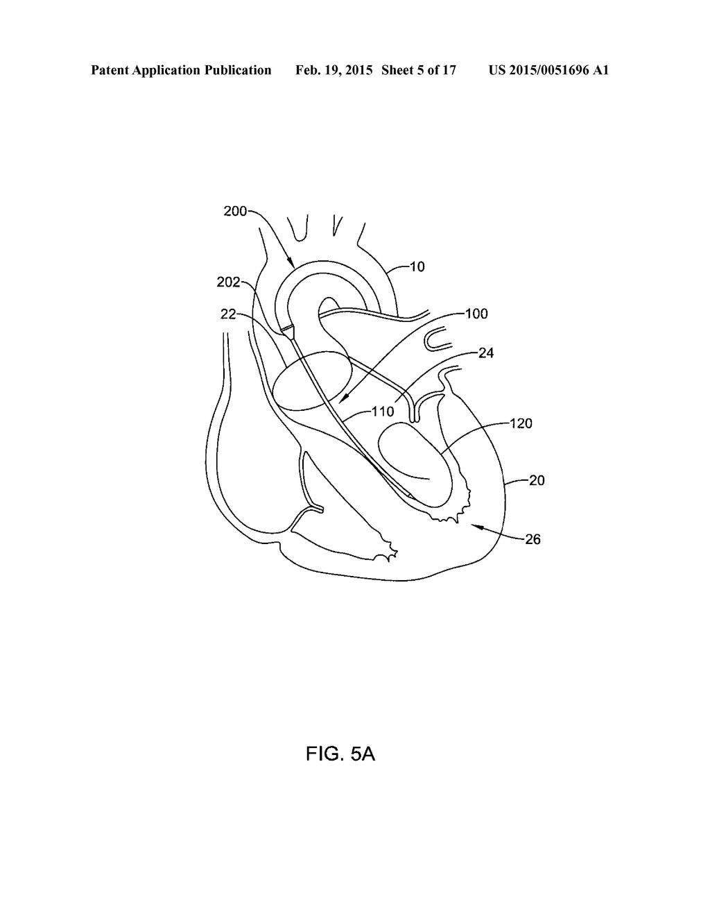 MEDICAL GUIDEWIRE - diagram, schematic, and image 06