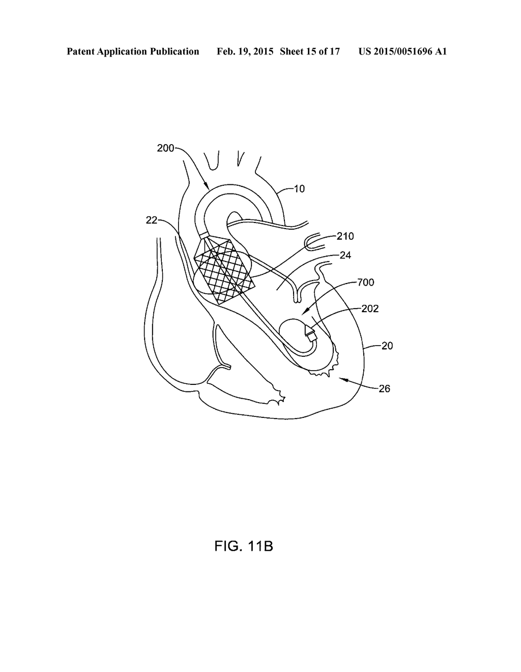 MEDICAL GUIDEWIRE - diagram, schematic, and image 16