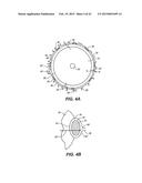 INTRAOCULAR IMPLANTS AND RELATED KITS AND METHODS diagram and image