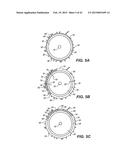 INTRAOCULAR IMPLANTS AND RELATED KITS AND METHODS diagram and image