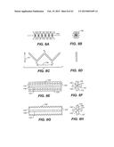 INTRAOCULAR IMPLANTS AND RELATED KITS AND METHODS diagram and image