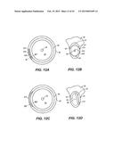INTRAOCULAR IMPLANTS AND RELATED KITS AND METHODS diagram and image