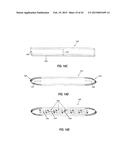 INTRAOCULAR IMPLANTS AND RELATED KITS AND METHODS diagram and image