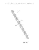 INTRAOCULAR IMPLANTS AND RELATED KITS AND METHODS diagram and image