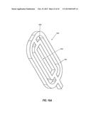 INTRAOCULAR IMPLANTS AND RELATED KITS AND METHODS diagram and image