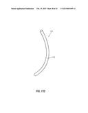 INTRAOCULAR IMPLANTS AND RELATED KITS AND METHODS diagram and image