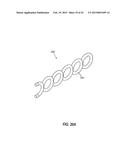 INTRAOCULAR IMPLANTS AND RELATED KITS AND METHODS diagram and image