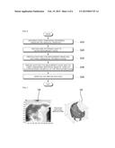 METHOD OF VERIFYING A SURGICAL OPERATION IMAGE MATCHING AND METHOD OF     COMPENSATING A SURGICAL OPERATION IMAGE MATCHING diagram and image