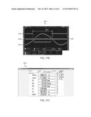 IMPEDANCE TUNING diagram and image