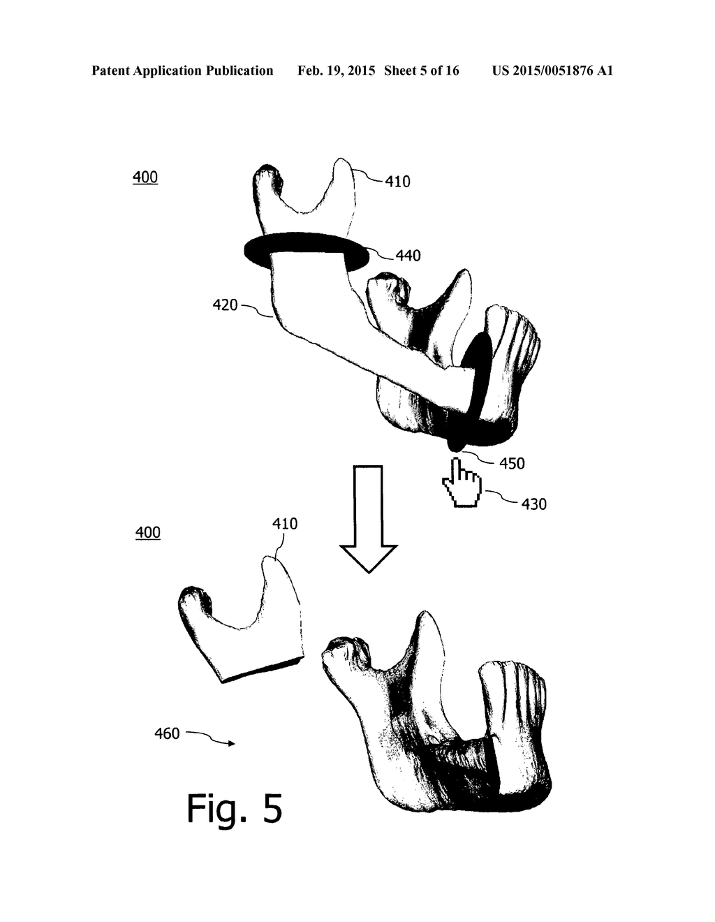 TECHNIQUE FOR GENERATING A BONE PLATE DESIGN - diagram, schematic, and image 06