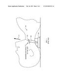 JAW THRUST APPARATUS diagram and image