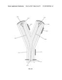 Particle Analyzing Systems and Methods Using Acoustic Radiation Pressure diagram and image