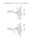 MOTOR-POWERED ARTICULATABLE SURGICAL INSTRUMENTS diagram and image