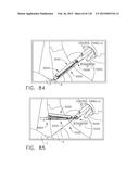 MOTOR-POWERED ARTICULATABLE SURGICAL INSTRUMENTS diagram and image