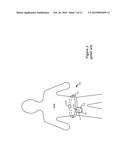 Self-Affixing External Charging System for an Implantable Medical Device diagram and image