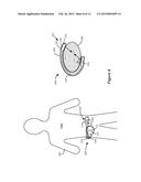 Self-Affixing External Charging System for an Implantable Medical Device diagram and image