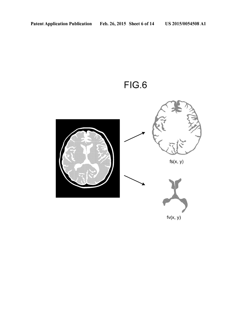 MAGNETIC RESONANCE IMAGING APPARATUS AND IMAGE PROCESSING APPARATUS - diagram, schematic, and image 07