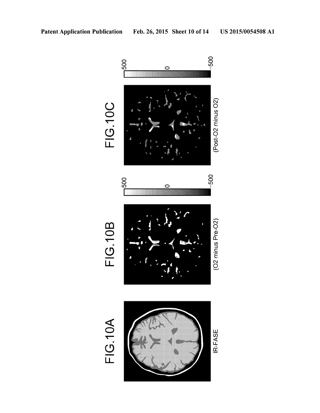 MAGNETIC RESONANCE IMAGING APPARATUS AND IMAGE PROCESSING APPARATUS - diagram, schematic, and image 11