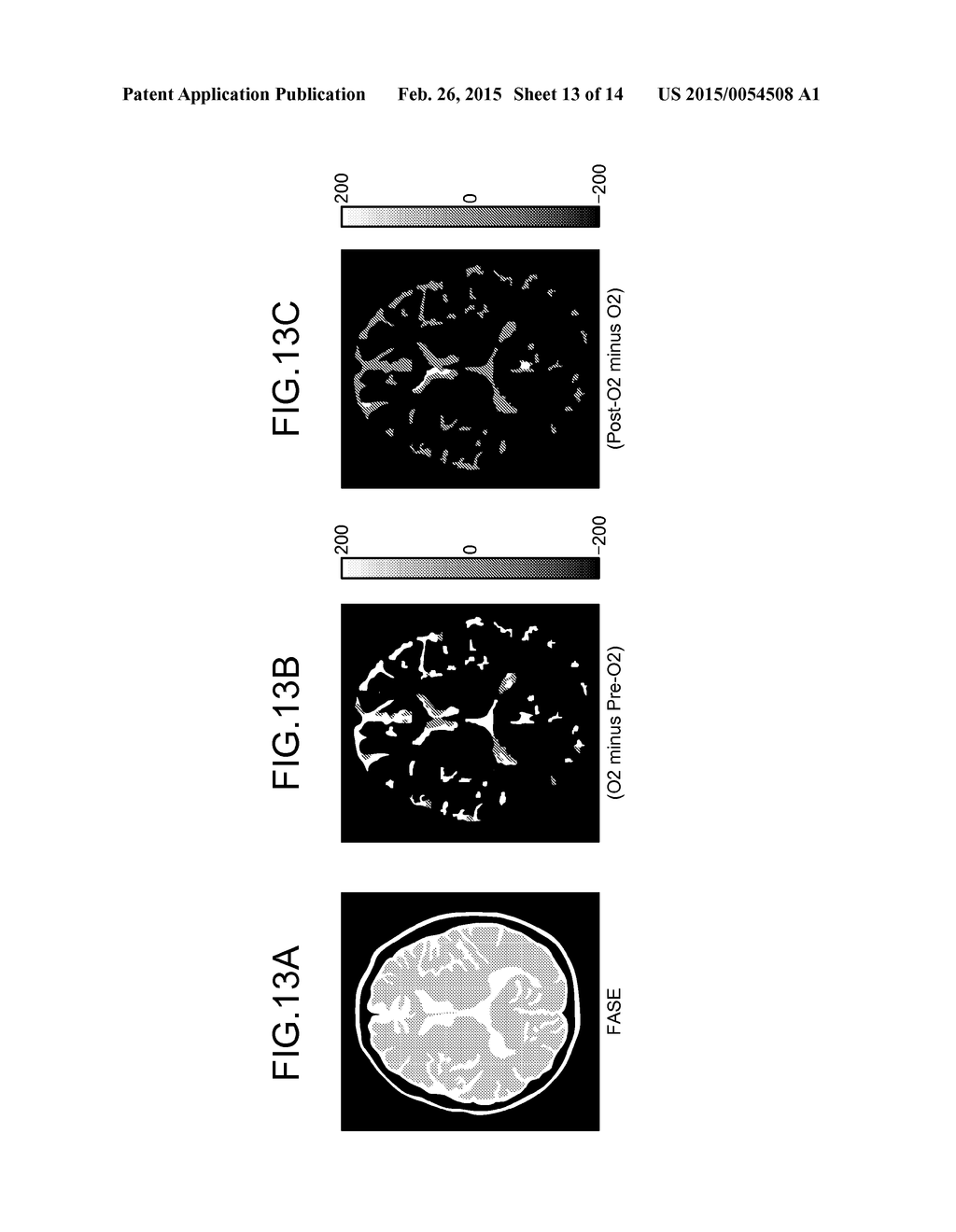 MAGNETIC RESONANCE IMAGING APPARATUS AND IMAGE PROCESSING APPARATUS - diagram, schematic, and image 14