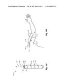 ANGULAR DISPLACEMENT SENSOR OF COMPLIANT MATERIAL diagram and image