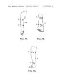 REHABILITATION DEVICE AND ASSISTIVE DEVICE FOR PHANTOM LIMB PAIN TREATMENT diagram and image