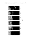 Ultrasound Image Object Boundary Localization by Intensity Histogram     Classification Using Relationships Among Boundaries diagram and image