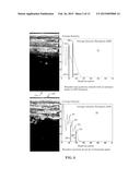 Ultrasound Image Object Boundary Localization by Intensity Histogram     Classification Using Relationships Among Boundaries diagram and image