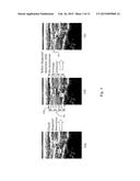 Ultrasound Image Object Boundary Localization by Intensity Histogram     Classification Using Relationships Among Boundaries diagram and image