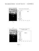 Ultrasound Image Object Boundary Localization by Intensity Histogram     Classification Using Relationships Among Boundaries diagram and image