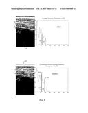 Ultrasound Image Object Boundary Localization by Intensity Histogram     Classification Using Relationships Among Boundaries diagram and image