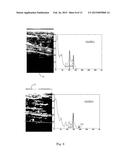 Ultrasound Image Object Boundary Localization by Intensity Histogram     Classification Using Relationships Among Boundaries diagram and image