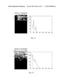 Ultrasound Image Object Boundary Localization by Intensity Histogram     Classification Using Relationships Among Boundaries diagram and image