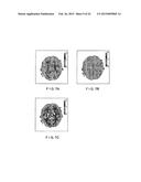 System, Method and Computer Accessible Medium for Providing Real-Time     Diffusional Kurtosis Imaging and for Facilitating Estimation of Tensors     and Tensor- Derived Measures in Diffusional Kurtosis Imaging diagram and image