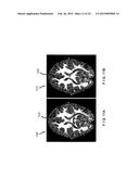 System, Method and Computer Accessible Medium for Providing Real-Time     Diffusional Kurtosis Imaging and for Facilitating Estimation of Tensors     and Tensor- Derived Measures in Diffusional Kurtosis Imaging diagram and image