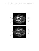 System, Method and Computer Accessible Medium for Providing Real-Time     Diffusional Kurtosis Imaging and for Facilitating Estimation of Tensors     and Tensor- Derived Measures in Diffusional Kurtosis Imaging diagram and image