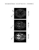 System, Method and Computer Accessible Medium for Providing Real-Time     Diffusional Kurtosis Imaging and for Facilitating Estimation of Tensors     and Tensor- Derived Measures in Diffusional Kurtosis Imaging diagram and image