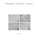 MODIFIED GREEN TEA POLYPHENOLS AND METHODS THEREOF FOR TREATING LIVER     DISEASE diagram and image