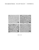 MODIFIED GREEN TEA POLYPHENOLS AND METHODS THEREOF FOR TREATING LIVER     DISEASE diagram and image