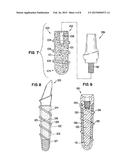 DENTAL IMPLANT FOR A JAW WITH REDUCED BONE VOLUME AND IMPROVED     OSSEOINTEGRATION FEATURES diagram and image