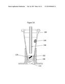 MICROFLUIDIC APPARATUS, METHOD, AND APPLICATIONS diagram and image