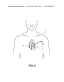 SYSTEM AND METHOD FOR SELECTIVELY COMMUNICATING WITH AN IMPLANTABLE     MEDICAL DEVICE diagram and image