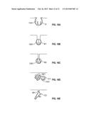 DOSIMETRICALLY CUSTOMIZABLE BRACHYTHERAPY CARRIERS AND METHODS THEREOF IN     THE TREATMENT OF TUMORS diagram and image