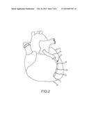 System and Method for Generating Electrophysiology Maps diagram and image